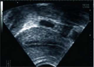 CE Ultraschall Scanner Vet Ultrasound scanner+Rektal  