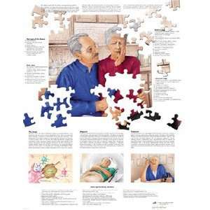  Parkinsons Disease Chart Industrial & Scientific