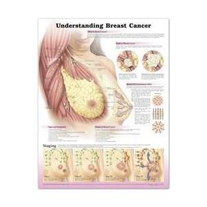 Understanding Breast Cancer Anatomical Chart, 2nd Edition  