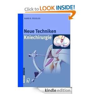 Neue Techniken   Kniechirurgie (German Edition) H.H. Pässler, H 